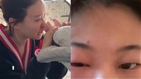 大陸34歲女演員吳悅菡近日聞了4個月大寶寶的腳丫子，導致眼睛感染。（圖／翻攝自微博）