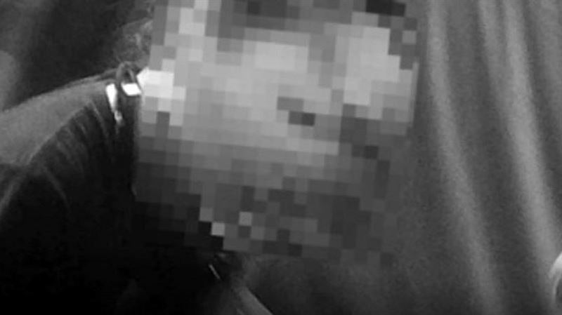 嘉義女飼主家中遭臘腸犬突襲！額頭撕裂