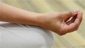 英國北愛爾蘭的一名40歲女子蘿倫（Lauren Bannon）發現自己的小指無法正常彎曲，詢問ChatGPT發現是罹患癌症，就醫檢查真的發現2個腫塊。（示意圖／Pixabay）