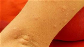 蚊子，蚊蟲叮咬（圖／翻攝自pixabay）