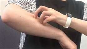 她幫抓癢一小時4千排長龍　專家：爽翻天