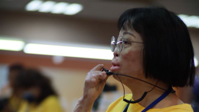 9歲童工廠火災倖存　弟喪命心痛至今難癒