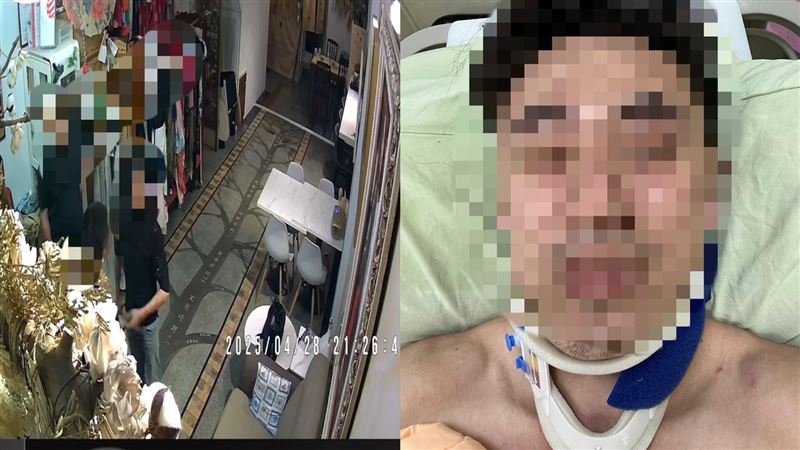 賴帳…誣鑽石失竊！89把老闆打到眼半失明