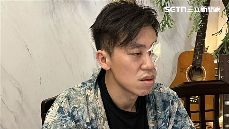 民宿老闆遭誣陷暴打「獨眼」現身：遭設局