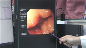 上班族壓力大，胃潰瘍導致腸阻塞，一個月爆瘦逾5公斤，大甲李綜合醫院外科主任邱昱瑞(圖／大甲李綜合提供)