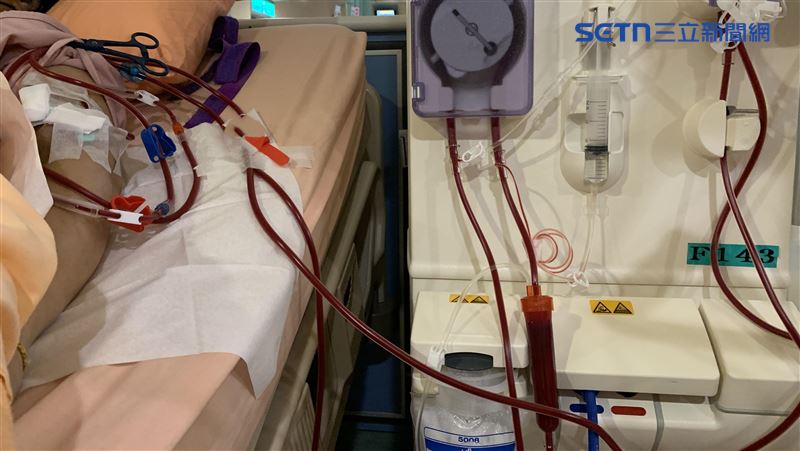 糖尿病患者如果不透過藥物控制、改善生活習慣，難逃洗腎命運。(圖／門諾醫院提供)