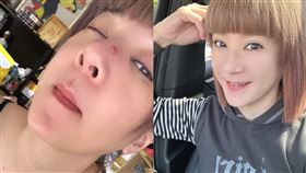 陸元琪表示跌倒重摔，撞到鼻樑流血。（圖／翻攝自臉書）