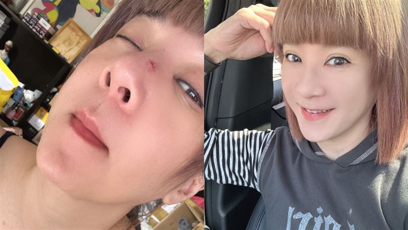 54歲女星樓梯重摔！嚇喊：起來看到滿地血