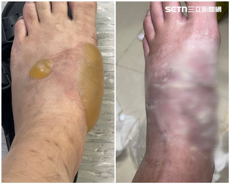 老闆左腳遭滾燙的珍珠燙傷,無預警店休,無公告回歸時間,不少網友敲碗詢問。(圖/翻攝畫面)