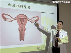 出國前腹痛掛急診　台中婦急切囊腫保卵巢（圖／翻攝畫面）