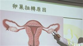 出國前腹痛掛急診　台中婦急切囊腫保卵巢（圖／翻攝畫面）