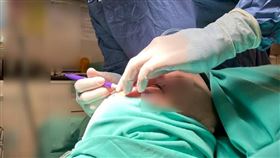 ▲潘致浩醫師表示：「眼袋重＝漏財相」顯老又沒精神，只要處理保養好加心情好有助回春。（圖／潘致浩醫師提供） 