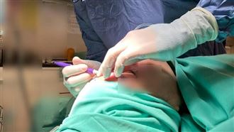 老翁散步竟被拉去「割眼袋」負責人這樣回