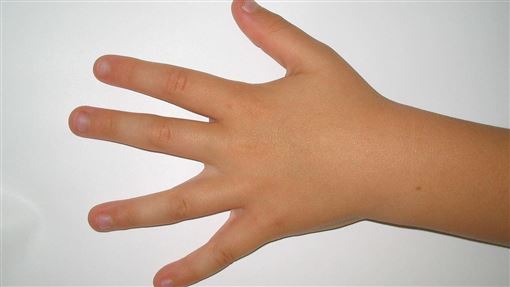 指甲冒白點≠缺鈣！醫揭警訊 快吃4類食物