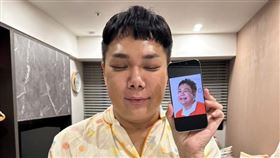 關韶文二度做正顎手術。（圖／翻攝自臉書）