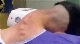 男子長期使用安非他命，患垂頭症候群。（圖／翻攝Spooky X）

