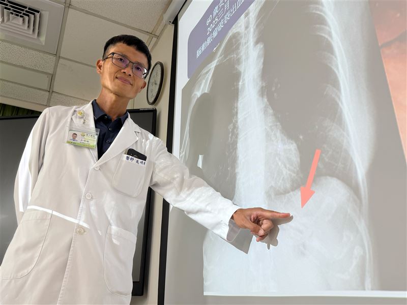 醫師利用異物夾把糾結成一團的鼻胃管拆解後,順利移除。(圖/臺中醫院提供)