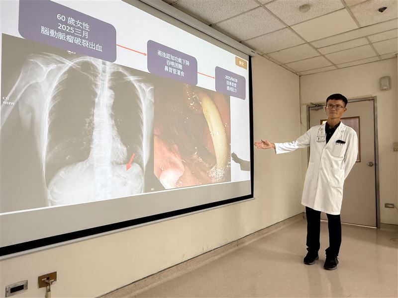 台中60歲女拔除鼻胃管時,異常疼痛且拔不出來,照X光才發現,鼻胃管竟在胃內打結。(圖/臺中醫院提供)