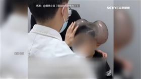 5個月完成2次手術　男童變開朗自信愛拍照
