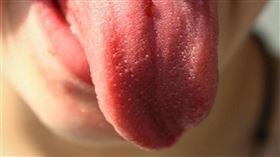 ▲大陸一名男子舌頭起水泡不當一回事，反覆潰瘍後變嚴重，就醫發現是舌癌，差點整根舌頭要切除，最後經多項手術保住臉部和舌頭。（示意圖非當事人／Pixabay）