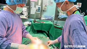 ▲六旬男罹腸癌 四年來復發轉移 南投醫院溫熱療法成功克癌。（圖／南投醫院提供） 