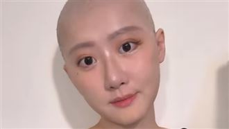 國光女神卵巢癌！5類人高風險 這年紀好發