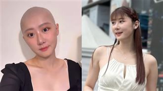 國光女神惡性卵巢癌！「寧靜殺手」易復發