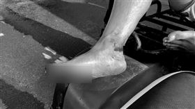 大安濱海浴場，藏生鏽鐵釘，遊客腳刺傷，血流如注，施工廢棄物(圖／翻攝畫面)