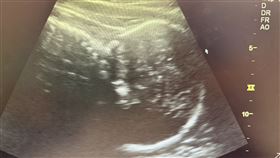 台74線，懷孕34週，產檢遇劫，狂飆168公里高速追撞　翻滾3圈驚悚畫面曝(圖／翻攝畫面)