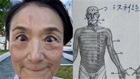 譚艾珍得了皮蛇。（圖／翻攝自臉書）