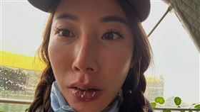 曾格爾曬出傷勢（圖／翻攝臉書）