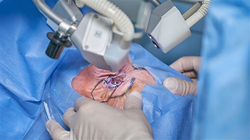 血糖飆八百突昏倒！眼球血管竟全爆開了