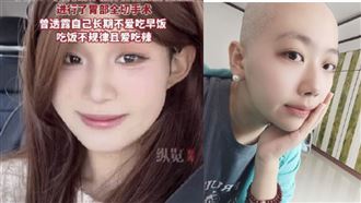 25歲網紅胃癌逝！「4現象」是早期症狀