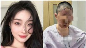 中國美妝網紅童瑤因家中發生瓦斯氣爆，導致身體大面積燒傷。（翻攝微博）