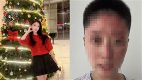美妝博主佟詩瑤近來因家中瓦斯外洩爆炸，她的臉部慘遭「毀容式燒傷」。（圖／翻攝自微博）
