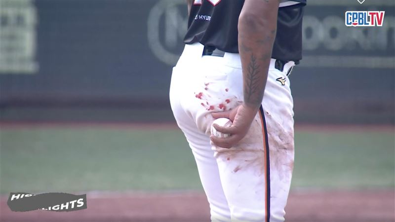 飛力獅手指流血沾染球褲。(圖/翻攝自CPBLTV)