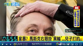 ▲馬斯克在白宮與川普同台記者會上，右眼掛著明顯瘀青。（圖／翻攝三立新聞網畫面）