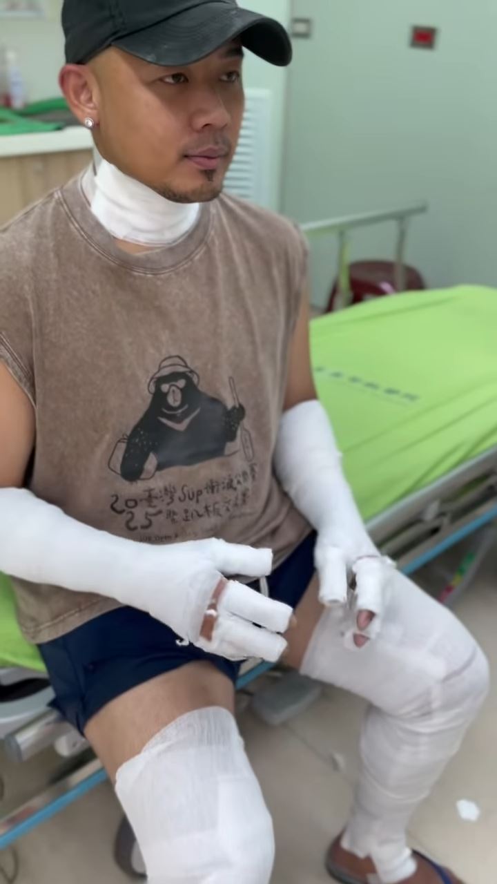 紀曉君老公二度燒傷，還原氣爆案發生經過。（圖／翻攝自紀曉君IG）