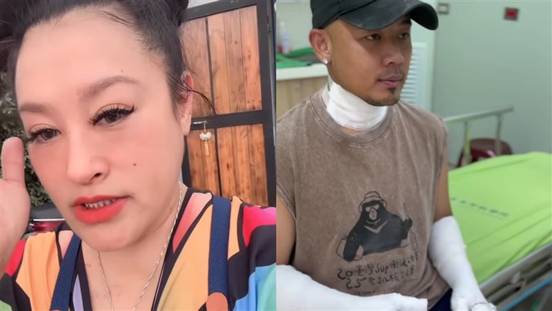 紀曉君老公氣爆二度燒傷　首還原事發經過