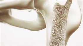 治療骨質疏鬆目前有兩種方式，分別為抑制骨質流失與促進骨質生成，根據健保給付規定，病人確診骨鬆後，第一線先給付抑制骨質流失藥物，治療一年以後，病患仍然發生骨折，才會給付第二線促進骨質生成藥物。