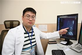 脊椎, X光片(圖/翻攝畫面)