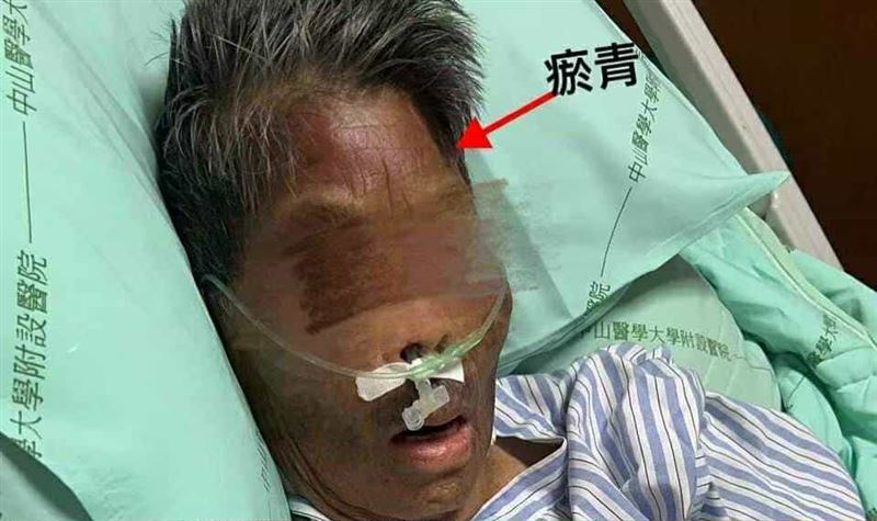 外籍看護粗暴毆打85歲阿嬤，過程全被監視器拍下。(圖／翻攝畫面)