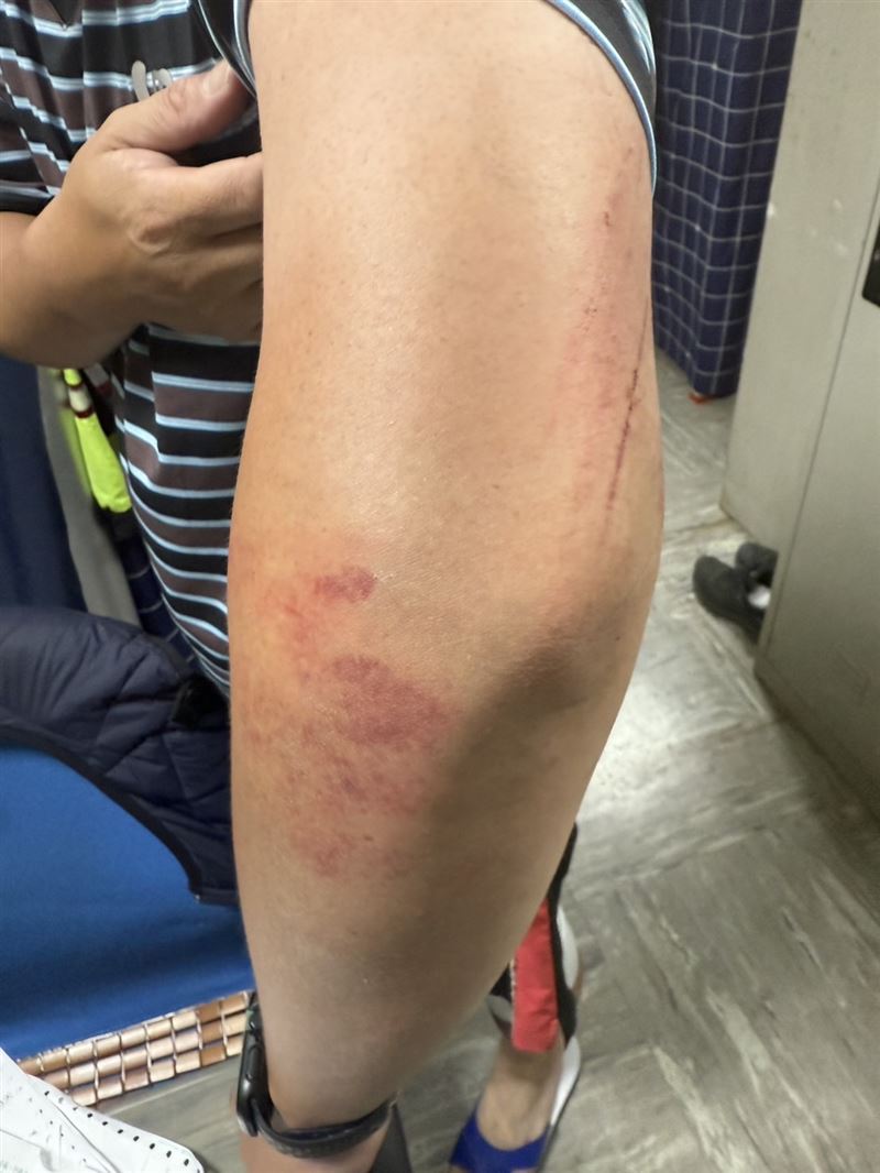 2名員警遭通緝犯撞飛傷勢曝光。(圖/翻攝畫面)
