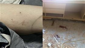 彰化縣花壇鄉,裝潢,工人,圓盤切割器,生殖器,睪丸,消防局,彰化基督教醫院（消防局、警方提供）