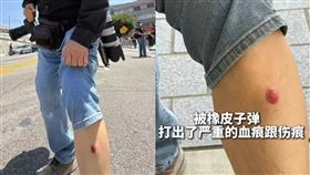 中國記者中彈。（圖／翻攝自新華社）