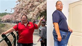 43歲男子，178公斤，縮胃曠腸手術，三個月甩36公斤，雨果(Hugo)機器手臂輔助(圖／中醫大附醫提供)