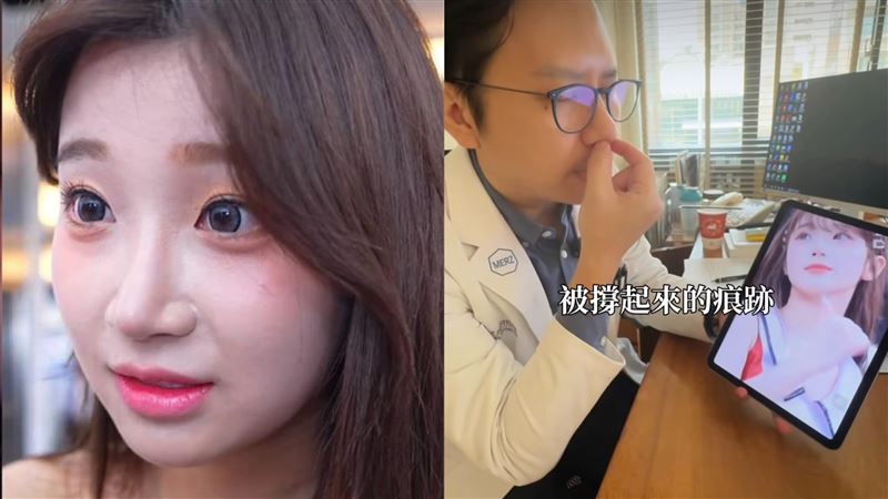 醫美醫師林建宏認為：李珠珢有動鼻子、眼睛、下巴，光鼻子大約花30萬，「做完之後人生開掛了」。（圖／翻攝自抖音、醫師林建宏IG）