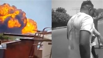 印度航空失事！男子身上染血、跛腳逃出