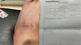 咬人,家犬,擺爛,過失傷害