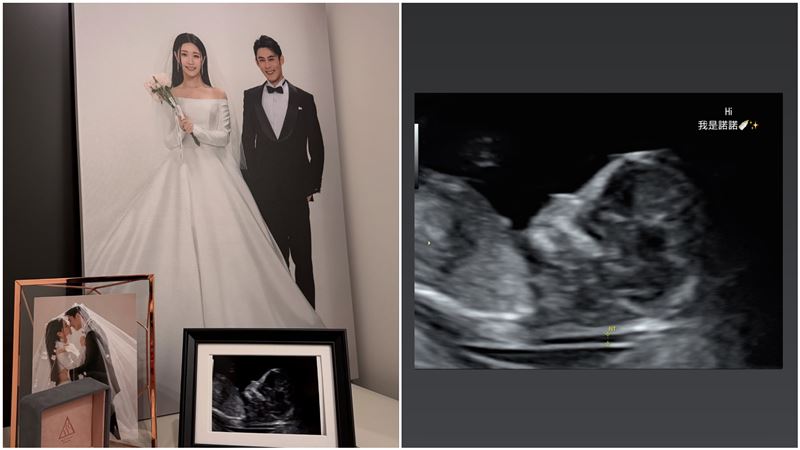 陳奕訂婚成衣千金！寶寶小名藏浪漫諧音哏